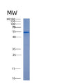 SDS-PAGE analysis of Human ALDH2 (Aldehyde Dehydrogenase, Mitochondrial) - Recombinant Protein, showing >95% purity under 15% SDS-PAGE (Reduced)