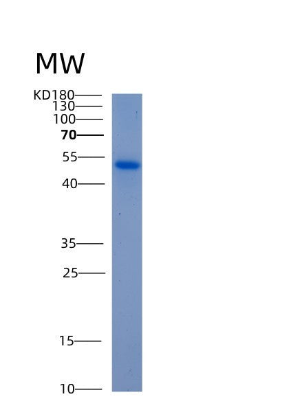 SDS-PAGE analysis of Human ALDH5A1 (Succinate-Semialdehyde Dehydrogenase, Mitochondrial) - Recombinant Protein, showing >85% purity under 15% SDS-PAGE (Reduced)