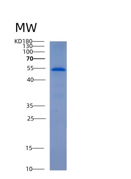 SDS-PAGE analysis of Human ALDH6A1 (Methylmalonate-Semialdehyde/Malonate-Semialdehyde Dehydrogenase [Acylating], Mitochondrial) - Recombinant Protein, showing >95% purity under 15% SDS-PAGE (Reduced)