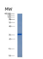 SDS-PAGE analysis of Human AKR1C4 (Aldo-Keto Reductase Family 1 Member C4) - Recombinant Protein, showing >95% purity under 15% SDS-PAGE (Reduced)
