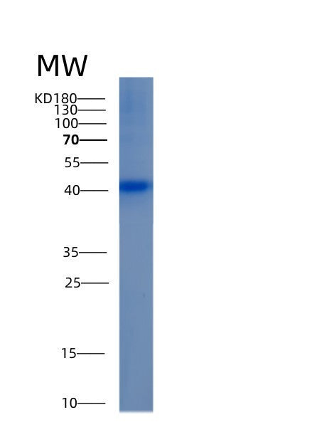 SDS-PAGE analysis of Human ALDOB (Fructose-Bisphosphate Aldolase B) - Recombinant Protein, showing >90% purity under 15% SDS-PAGE (Reduced)