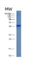SDS-PAGE analysis of Human ALDOB (Fructose-Bisphosphate Aldolase B) - Recombinant Protein, showing >90% purity under 15% SDS-PAGE (Reduced)