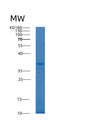 SDS-PAGE analysis of Human ALKBH3 (Alpha-Ketoglutarate-Dependent Dioxygenase Alkb Homolog 3) - Recombinant Protein, showing >90% purity under 15% SDS-PAGE (Reduced)