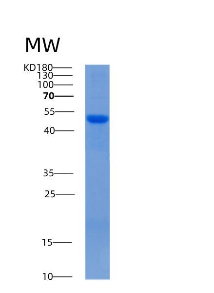 SDS-PAGE analysis of Mouse Serpinf2 (Alpha-2-Antiplasmin) - Recombinant Protein, showing >85% purity under 15% SDS-PAGE (Reduced)