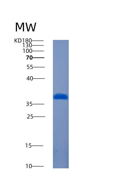 SDS-PAGE analysis of Human AMMECR1L (Ammecr1-Like Protein) - Recombinant Protein, showing >90% purity under 15% SDS-PAGE (Reduced)