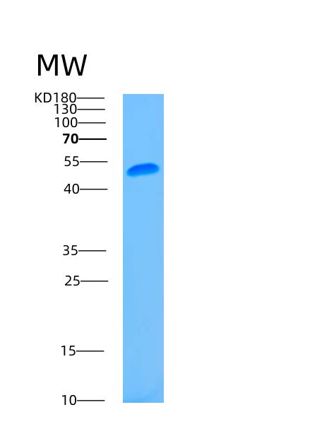 SDS-PAGE analysis of Human ASL (Argininosuccinate Lyase) - Recombinant Protein, showing >95% purity under 15% SDS-PAGE (Reduced)