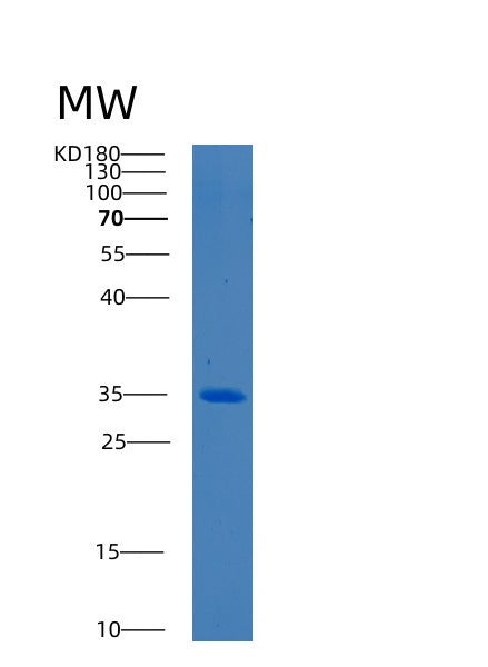 SDS-PAGE analysis of Human BCDIN3D (Rna 5'-Monophosphate Methyltransferase) - Recombinant Protein, showing >85% purity under 15% SDS-PAGE (Reduced)