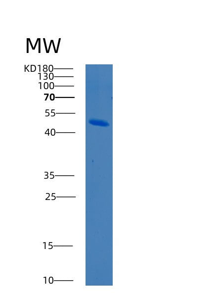 SDS-PAGE analysis of Human BCKDHA (2-Oxoisovalerate Dehydrogenase Subunit Alpha, Mitochondrial) - Recombinant Protein, showing >95% purity under 15% SDS-PAGE (Reduced)