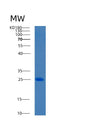 SDS-PAGE analysis of Human BCL7C (B-Cell Cll/Lymphoma 7 Protein Family Member C) - Recombinant Protein, showing >95% purity under 15% SDS-PAGE (Reduced)