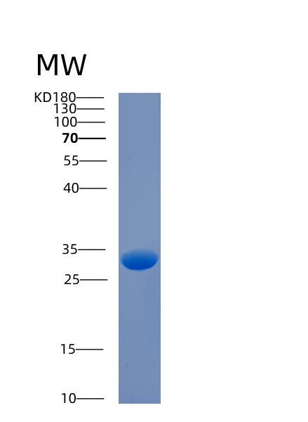SDS-PAGE analysis of Human CA3 (Carbonic Anhydrase 3) - Recombinant Protein, showing >90% purity under 15% SDS-PAGE (Reduced)