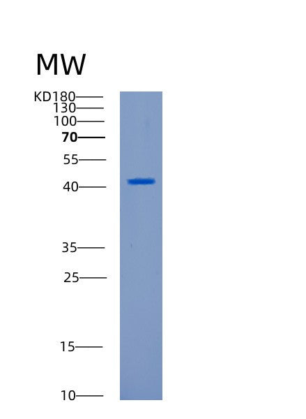 SDS-PAGE analysis of Human CANT1 (Soluble Calcium-Activated Nucleotidase 1) - Recombinant Protein, showing >90% purity under 15% SDS-PAGE (Reduced)
