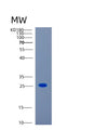 SDS-PAGE analysis of Human CAPSL (Calcyphosin-Like Protein) - Recombinant Protein, showing >85% purity under 15% SDS-PAGE (Reduced)