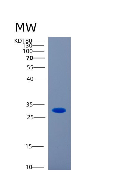 SDS-PAGE analysis of Human CA1 (Carbonic Anhydrase 1) - Recombinant Protein, showing >85% purity under 15% SDS-PAGE (Reduced)