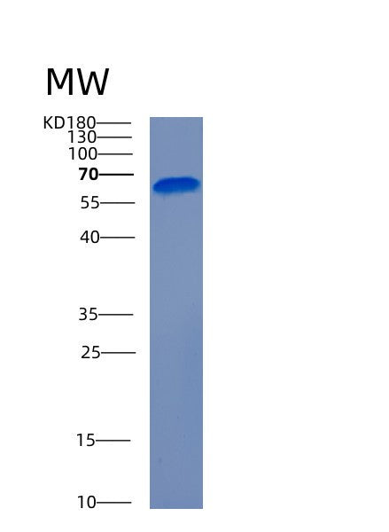 SDS-PAGE analysis of Human ADA2 (Adenosine Deaminase 2) - Recombinant Protein, showing >90% purity under 15% SDS-PAGE (Reduced)