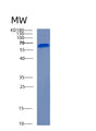 SDS-PAGE analysis of Human ADA2 (Adenosine Deaminase 2) - Recombinant Protein, showing >90% purity under 15% SDS-PAGE (Reduced)