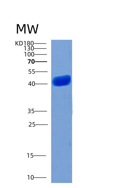 SDS-PAGE analysis of Human CHI3L1 (Chitinase-3-Like Protein 1) - Recombinant Protein, showing >85% purity under 15% SDS-PAGE (Reduced)