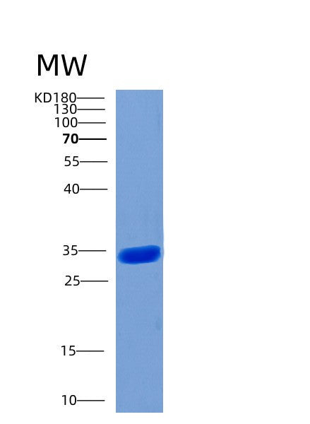 SDS-PAGE analysis of Human STUB1 (E3 Ubiquitin-Protein Ligase Chip) - Recombinant Protein, showing >95% purity under 15% SDS-PAGE (Reduced)