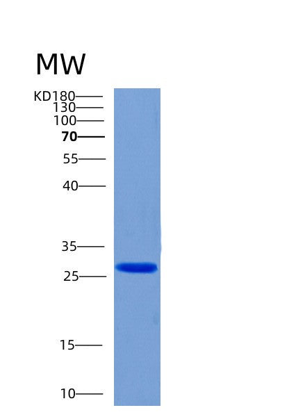 SDS-PAGE analysis of Human CHMP6 (Charged Multivesicular Body Protein 6) - Recombinant Protein, showing >95% purity under 15% SDS-PAGE (Reduced)
