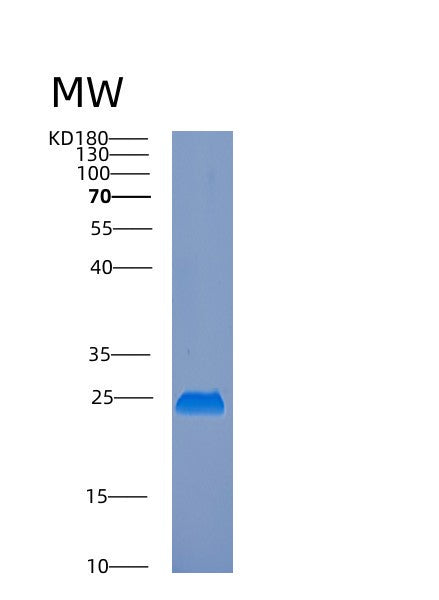 SDS-PAGE analysis of Human EMC8 (Er Membrane Protein Complex Subunit 8) - Recombinant Protein, showing >90% purity under 15% SDS-PAGE (Reduced)