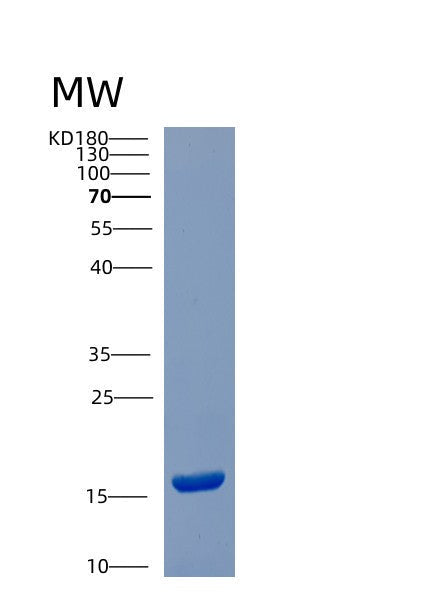 SDS-PAGE analysis of Human CST6 (Cystatin-M) - Recombinant Protein, showing >95% purity under 15% SDS-PAGE (Reduced)