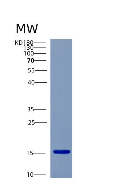 SDS-PAGE analysis of Human CST7 (Cystatin-F) - Recombinant Protein, showing >85% purity under 15% SDS-PAGE (Reduced)