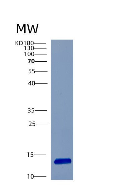 SDS-PAGE analysis of Human CSTA (Cystatin-A) - Recombinant Protein, showing >85% purity under 15% SDS-PAGE (Reduced)