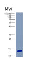 SDS-PAGE analysis of Human CSTA (Cystatin-A) - Recombinant Protein, showing >85% purity under 15% SDS-PAGE (Reduced)