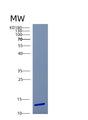 SDS-PAGE analysis of Human CSTB (Cystatin-B) - Recombinant Protein, showing >90% purity under 15% SDS-PAGE (Reduced)