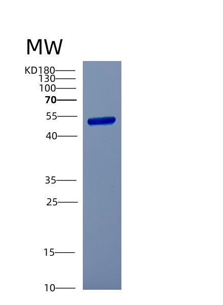 SDS-PAGE analysis of Human CSTF1 (Cleavage Stimulation Factor Subunit 1) - Recombinant Protein, showing >85% purity under 15% SDS-PAGE (Reduced)