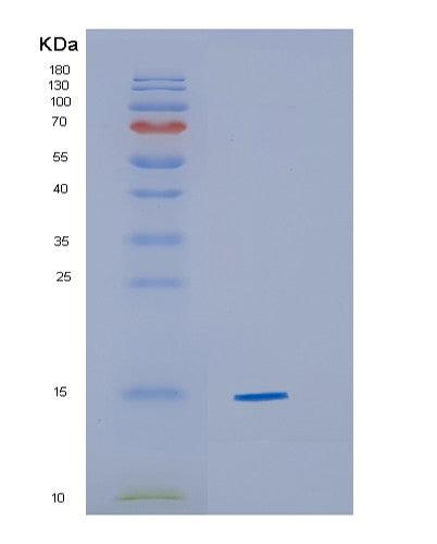 SDS-PAGE analysis of Human CYB5A (Cytochrome B5) - Recombinant Protein, showing >95% purity under 15% SDS-PAGE (Reduced)