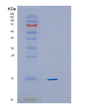 SDS-PAGE analysis of Human CYB5A (Cytochrome B5) - Recombinant Protein, showing >95% purity under 15% SDS-PAGE (Reduced)