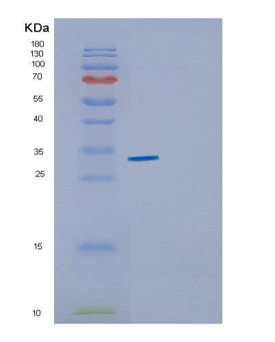 SDS-PAGE analysis of Human CYB5R1 (Nadh-Cytochrome B5 Reductase 1) - Recombinant Protein, showing >90% purity under 15% SDS-PAGE (Reduced)