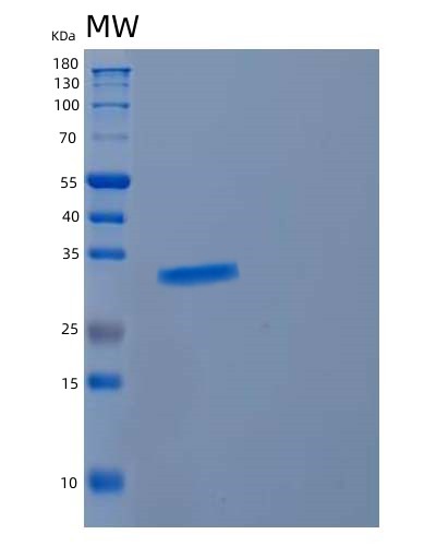 SDS-PAGE analysis of Human CYB5R2 (Nadh-Cytochrome B5 Reductase 2) - Recombinant Protein, showing >85% purity under 15% SDS-PAGE (Reduced)
