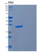 SDS-PAGE analysis of Human CYB5R2 (Nadh-Cytochrome B5 Reductase 2) - Recombinant Protein, showing >85% purity under 15% SDS-PAGE (Reduced)