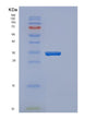SDS-PAGE analysis of Human CYB5R3 (Nadh-Cytochrome B5 Reductase 3) - Recombinant Protein, showing >95% purity under 15% SDS-PAGE (Reduced)