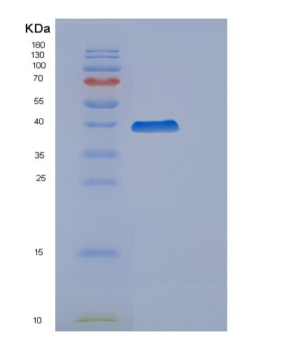 SDS-PAGE analysis of Human CCNH (Cyclin-H) - Recombinant Protein, showing >90% purity under 15% SDS-PAGE (Reduced)