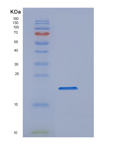 SDS-PAGE analysis of Human PPIA (Peptidyl-Prolyl Cis-Trans Isomerase A) - Recombinant Protein, showing >85% purity under 15% SDS-PAGE (Reduced)