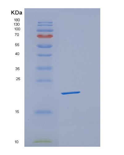 SDS-PAGE analysis of Human PPIG (Peptidyl-Prolyl Cis-Trans Isomerase G) - Recombinant Protein, showing >95% purity under 15% SDS-PAGE (Reduced)