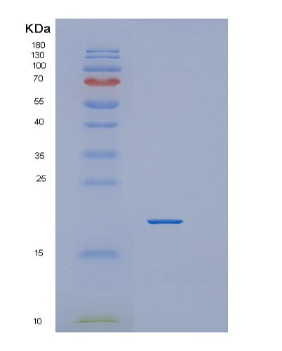 SDS-PAGE analysis of Human PPIH (Peptidyl-Prolyl Cis-Trans Isomerase H) - Recombinant Protein, showing >90% purity under 15% SDS-PAGE (Reduced)