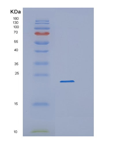SDS-PAGE analysis of Human CYGB (Cytoglobin) - Recombinant Protein, showing >85% purity under 15% SDS-PAGE (Reduced)