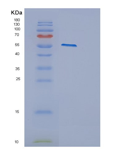 SDS-PAGE analysis of Human CYP2E1 (Cytochrome P450 2E1) - Recombinant Protein, showing >95% purity under 15% SDS-PAGE (Reduced)