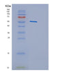 SDS-PAGE analysis of Human CYP2E1 (Cytochrome P450 2E1) - Recombinant Protein, showing >95% purity under 15% SDS-PAGE (Reduced)