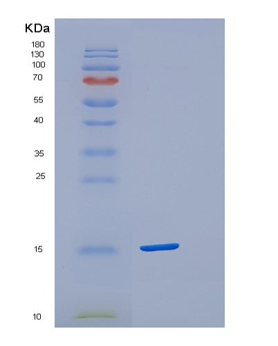 SDS-PAGE analysis of Human CST4 (Cystatin-S) - Recombinant Protein, showing >90% purity under 15% SDS-PAGE (Reduced)
