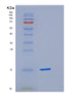 SDS-PAGE analysis of Human CST4 (Cystatin-S) - Recombinant Protein, showing >90% purity under 15% SDS-PAGE (Reduced)