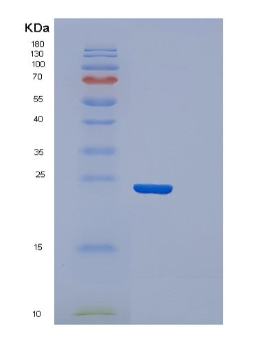 SDS-PAGE analysis of Human CDO1 (Cysteine Dioxygenase Type 1) - Recombinant Protein, showing >85% purity under 15% SDS-PAGE (Reduced)