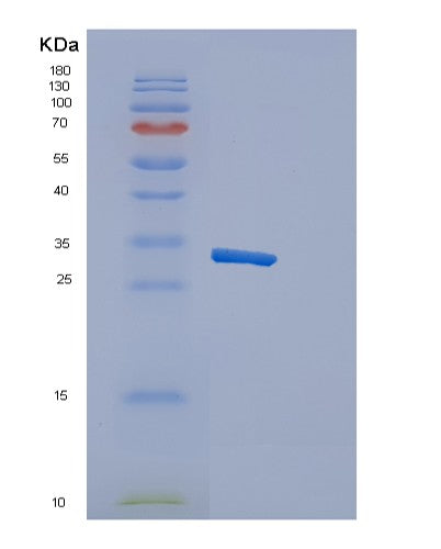 SDS-PAGE analysis of Human CRTAM (Cytotoxic And Regulatory T-Cell Molecule) - Recombinant Protein, showing >85% purity under 15% SDS-PAGE (Reduced)