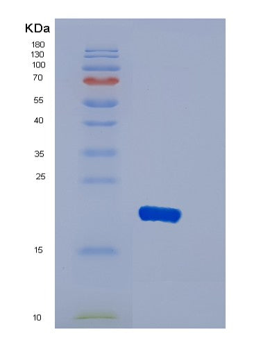 SDS-PAGE analysis of Human DBNDD2 (Dysbindin Domain-Containing Protein 2) - Recombinant Protein, showing >95% purity under 15% SDS-PAGE (Reduced)