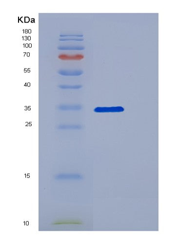 SDS-PAGE analysis of Human DCK (Deoxycytidine Kinase) - Recombinant Protein, showing >95% purity under 15% SDS-PAGE (Reduced)