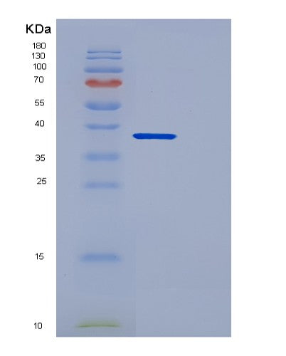 SDS-PAGE analysis of Human DCN (Decorin) - Recombinant Protein, showing >90% purity under 15% SDS-PAGE (Reduced)