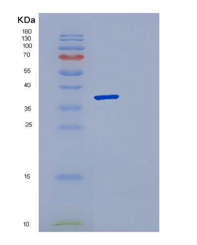 SDS-PAGE analysis of Human DCN (Decorin) - Recombinant Protein, showing >85% purity under 15% SDS-PAGE (Reduced)